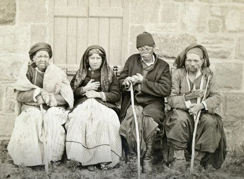 Историческая фотография прокажённых людей конца XIX — начала XX века